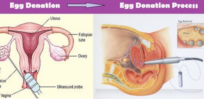 طفل الأنبوب مع تقنية وهب البويضات لبنان, دكتور نجيب داغر, تبرع بالبويضات, التبرع بالبويضات في لبنان